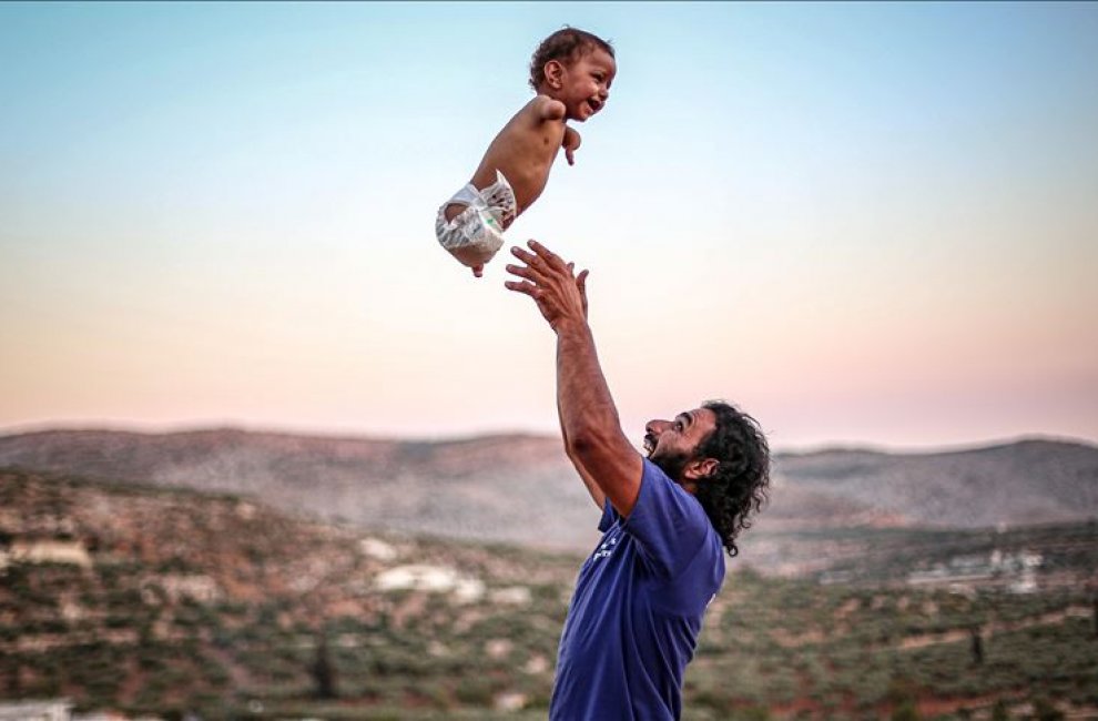 Маленький сириец без рук и ног борется за жизнь в Идлибе